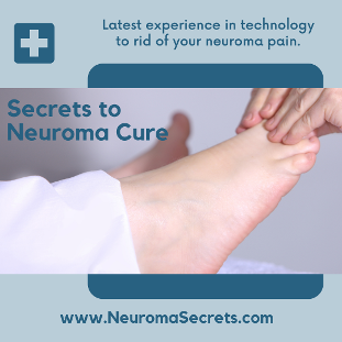 neuroma secrets